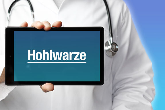 Schlupfwarzenkorrektur Krefeld